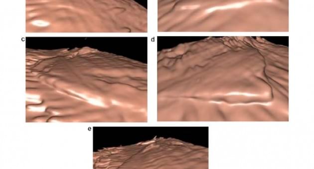 Віртуальна лапароскопія: перший досвід застосування тривимірної ультрасонографії FLY THRU з метою оцінки особливостей поверхні печінки - Статті RH