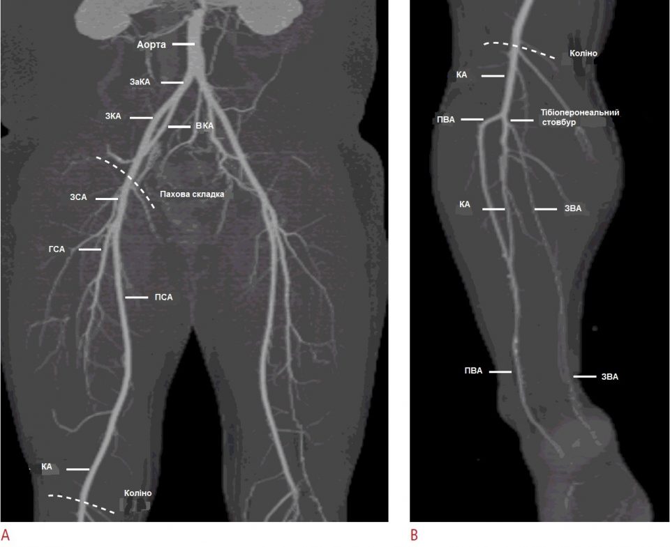 Артерии нижних конечностей схема на русском