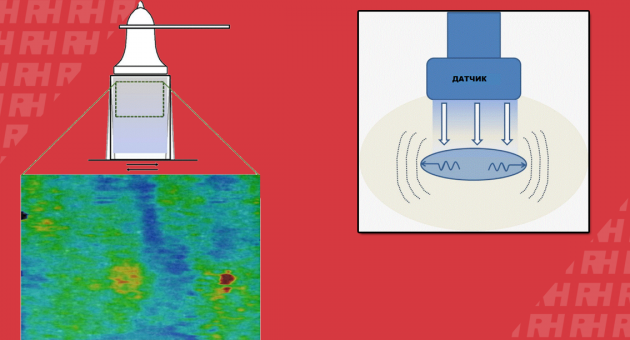 Клиническое использование эластографии сдвиговой волны в исследовании опорно-двигательной системы - Статьи RH