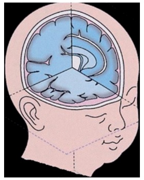 Тривимірна нейросонографія – нова - Малюнок1