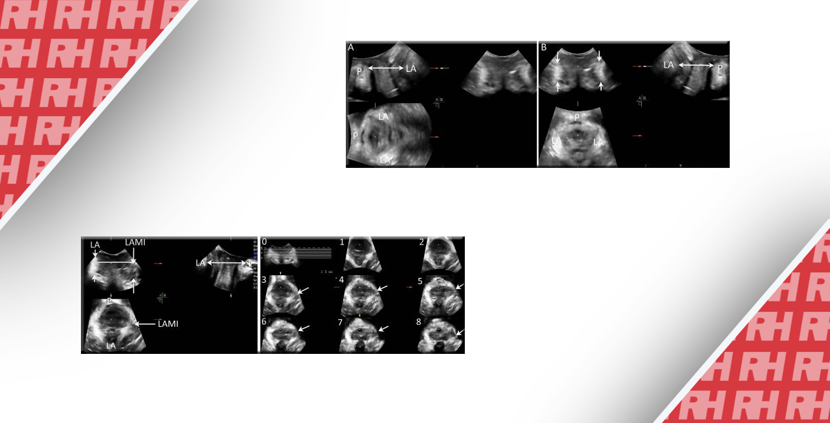 Ekstrena Ultrasonografiya Shlunkovo Kishkovogo Traktu U Ditej Medichni Statti Vid Rh