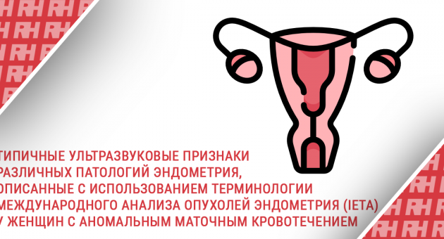Типичные ультразвуковые признаки различных патологий эндометрия, описанные с использованием терминологии Международного анализа опухолей эндометрия (IETA) у женщин с аномальным маточным кровотечением - Статьи RH