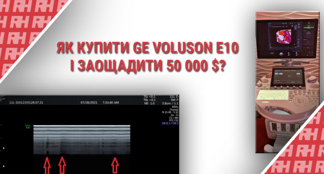 Як купити GE Voluson E10 і заощадити 50 000 $? - Статті RH