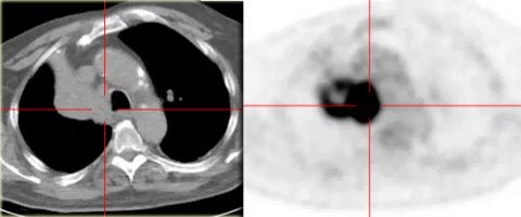Рентгенологическая оценка лёгких: норма - Рисунок3