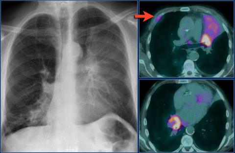 Рентгенологическая оценка лёгких: норма - Рисунок12