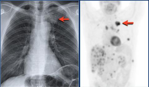 Рентгенологическая оценка лёгких: норма - Рисунок1