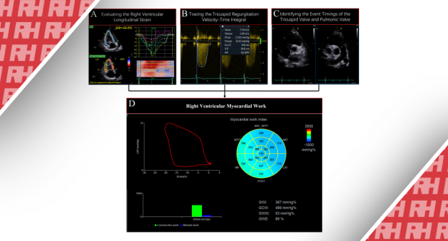 Estimated QpQs by echo and QpQs estimated by cath with line of   Download Scientific Diagram